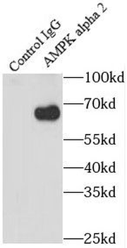 PRKAA2 Rabbit Polyclonal Antibody