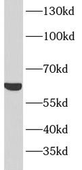 PRKAA2 Rabbit Polyclonal Antibody
