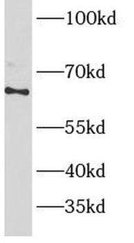 PRKAG2 Rabbit Polyclonal Antibody