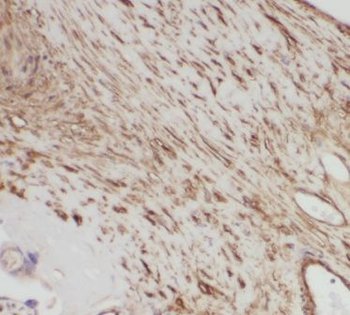 PRKAG2 Rabbit Polyclonal Antibody