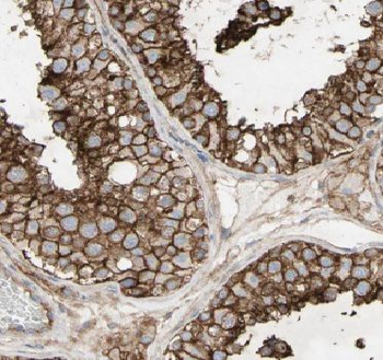 AMZ2 Rabbit Polyclonal Antibody