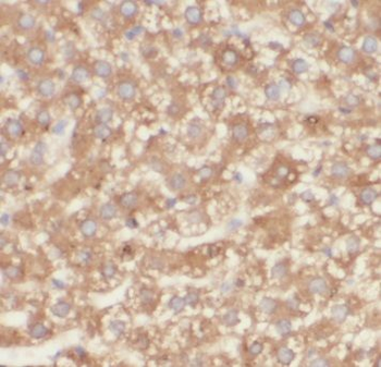 AGT Rabbit Polyclonal Antibody