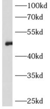 AGT Rabbit Polyclonal Antibody