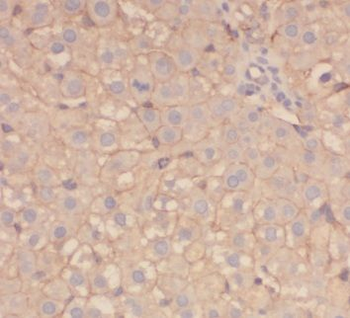 AGT Rabbit Polyclonal Antibody