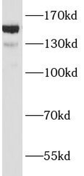 ANKRD11 Antibody