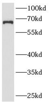 ANKRD13A Antibody