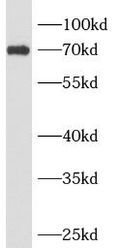 ANKRD13B Rabbit Polyclonal Antibody