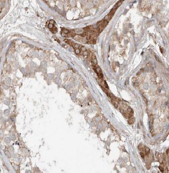 ANKRD13B Rabbit Polyclonal Antibody