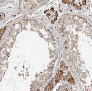ANKRD13C Rabbit Polyclonal Antibody