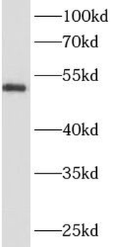 ANKRD13D Rabbit Polyclonal Antibody