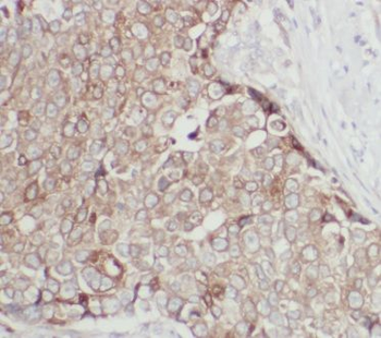 ANKRD13D Rabbit Polyclonal Antibody