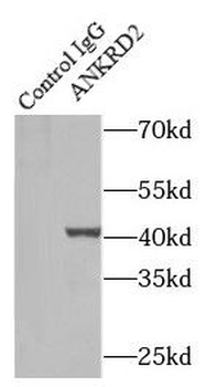 ANKRD2 Rabbit Polyclonal Antibody