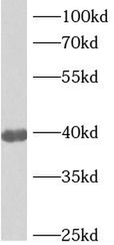 ANKRD2 Rabbit Polyclonal Antibody
