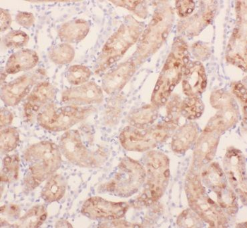 ANKRD2 Rabbit Polyclonal Antibody