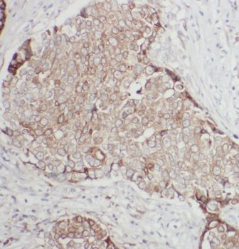 ANKRD26 Rabbit Polyclonal Antibody