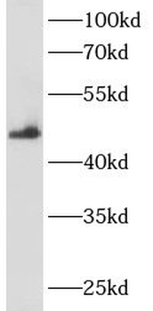 ANKRD33 Rabbit Polyclonal Antibody