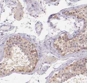 ANKRD33 Rabbit Polyclonal Antibody