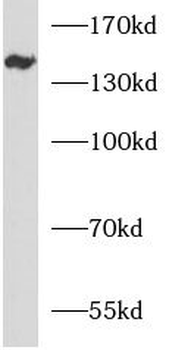 ANKRD50 Rabbit Polyclonal Antibody