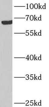 ANKRD53 Rabbit Polyclonal Antibody