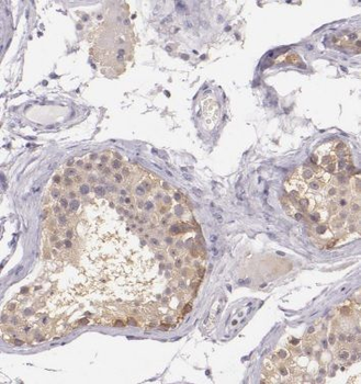 ANKRD53 Rabbit Polyclonal Antibody