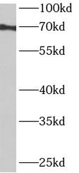 ANKRD55 Rabbit Polyclonal Antibody