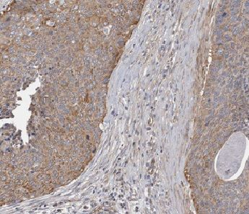 ANKRD55 Rabbit Polyclonal Antibody