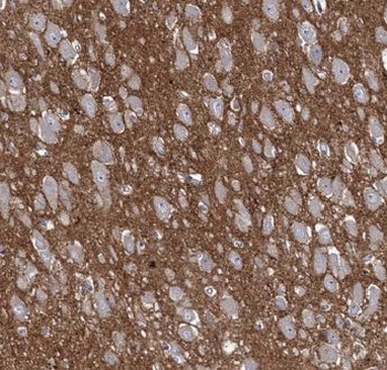 SOWAHC Rabbit Polyclonal Antibody