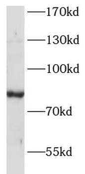ANKRD6 Rabbit Polyclonal Antibody