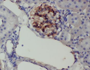 ANKRD6 Rabbit Polyclonal Antibody