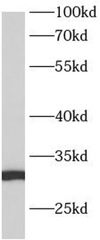 ANKRD7 Antibody