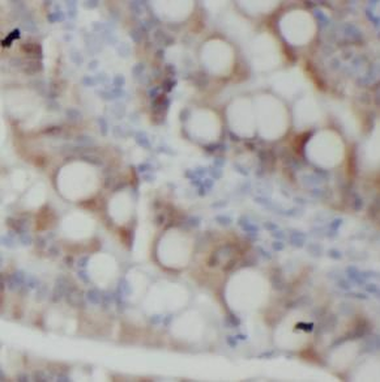 ANXA1 Rabbit Polyclonal Antibody