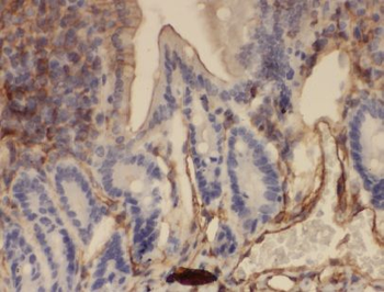ANXA13 Rabbit Polyclonal Antibody