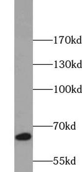 ANXA6 Rabbit Polyclonal Antibody