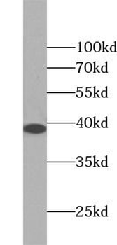 ANXA9 Rabbit Polyclonal Antibody