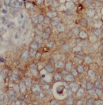 ANXA9 Rabbit Polyclonal Antibody