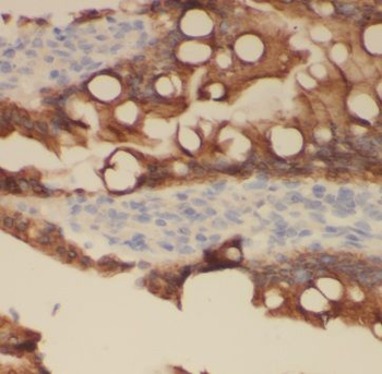 AOAH Rabbit Polyclonal Antibody