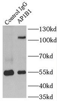 AP1B1 Rabbit Polyclonal Antibody
