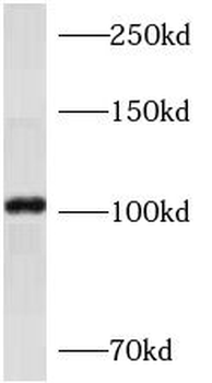 AP1B1 Rabbit Polyclonal Antibody