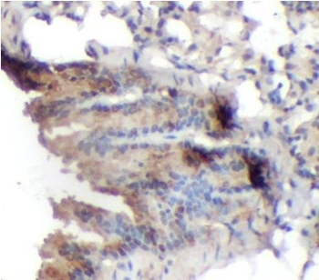 AP2B1 Rabbit Polyclonal Antibody