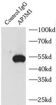 AP3M1 Antibody