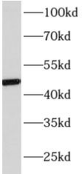 AP3M1 Rabbit Polyclonal Antibody