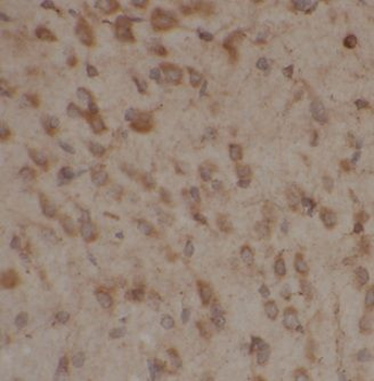 AP3M2 Rabbit Polyclonal Antibody