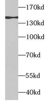 APAF1 Rabbit Polyclonal Antibody