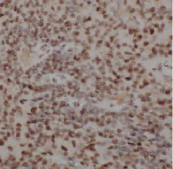 APOBEC3B Rabbit Polyclonal Antibody