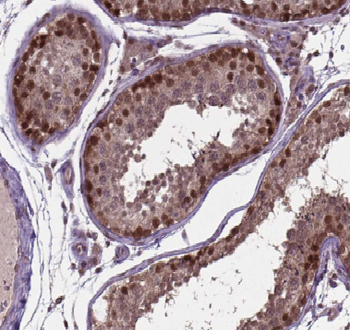 APOBEC4 Rabbit Polyclonal Antibody