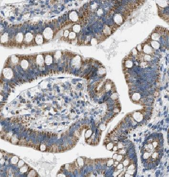 ARAP3 Antibody