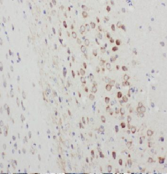 ARC Rabbit Polyclonal Antibody