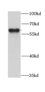 ARFGAP3 Antibody