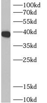 ADPRS Antibody