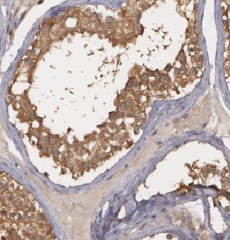 ADPRS Rabbit Polyclonal Antibody